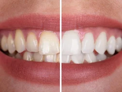 Dental Clinic in Anna Nagar Madurai